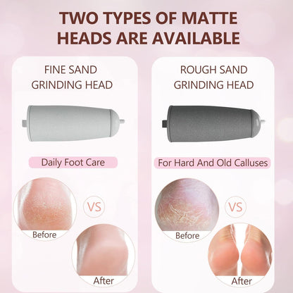 Electric Foot File and Callus Remover