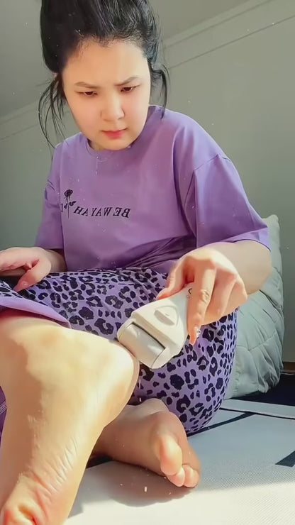 Electric Foot File and Callus Remover